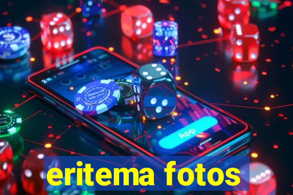 eritema fotos